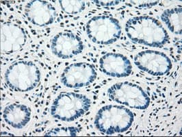 CHEK2 / CHK2 Antibody (clone OTI4C10)