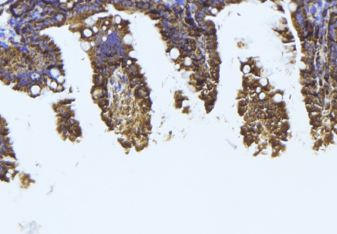 Polyclonal Rabbit anti-Human TUBB1 / Tubulin Beta 1 Antibody (IHC, IF, WB)