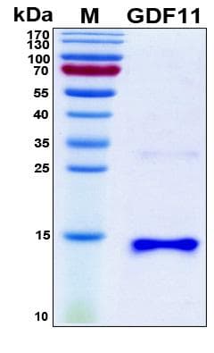 Human GDF11 / GDF-11 Protein (Recombinant 6His, N-terminus)
