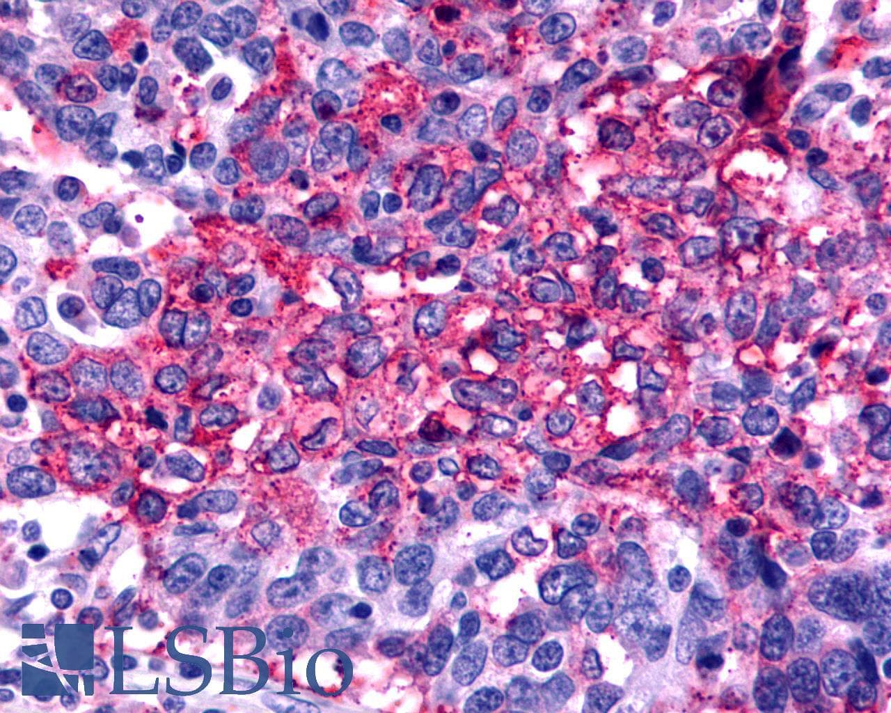 IHC-plus™ Polyclonal Rabbit anti-Human FZD2 / Frizzled 2 Antibody (N-Terminus, IHC)