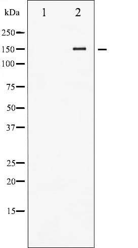Polyclonal Rabbit anti-Human KDR / VEGFR2 / FLK1 Antibody (phospho-Tyr1214, IHC, IF, WB)