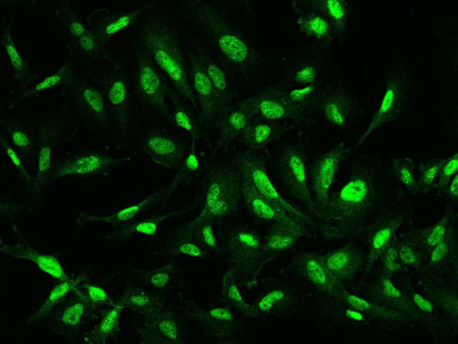 Polyclonal Rabbit anti-Human ATF7IP / MCAF1 Antibody (IF)