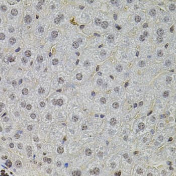 SKP2 Antibody