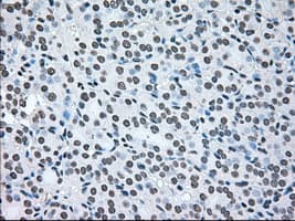 BRAF / B-Raf Antibody (clone OTI4C11)