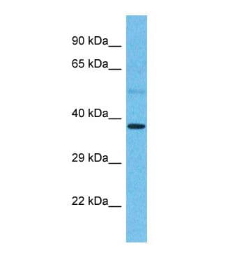 CCR2 Antibody (N-Terminus)