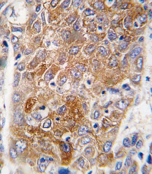 ALDH1L1 Antibody (aa717-746)