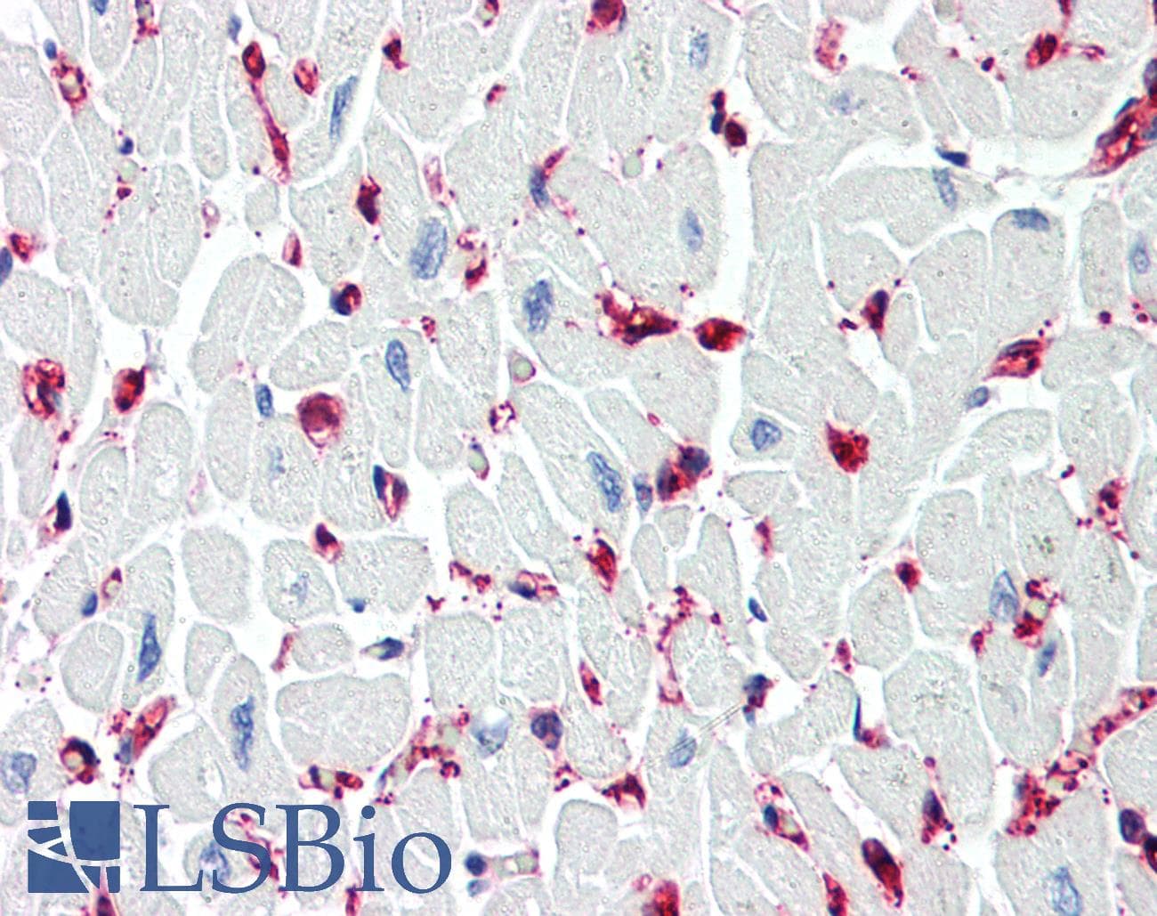 IHC-plus™ SIRT2 / Sirtuin 2 Antibody