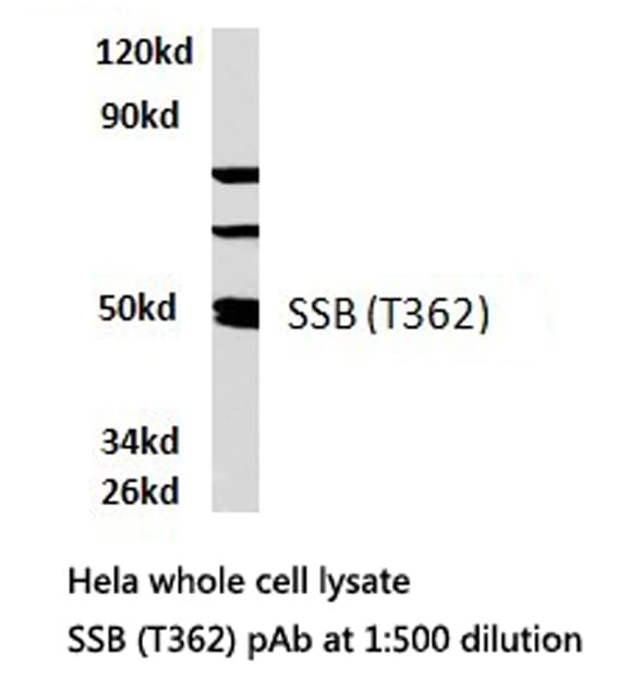 SSB / La Antibody (Thr362)