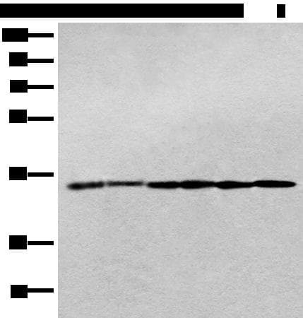 Polyclonal Rabbit anti-Human PITPNB Antibody (IHC, WB)