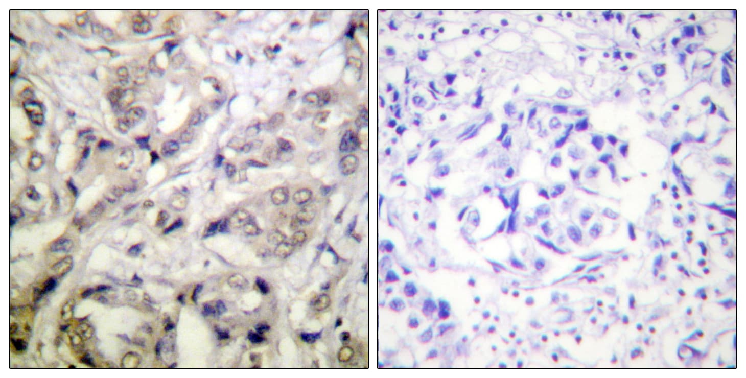 Polyclonal Rabbit anti-Human CAMK1 / CAMKI Antibody (aa143-192, IHC, WB)
