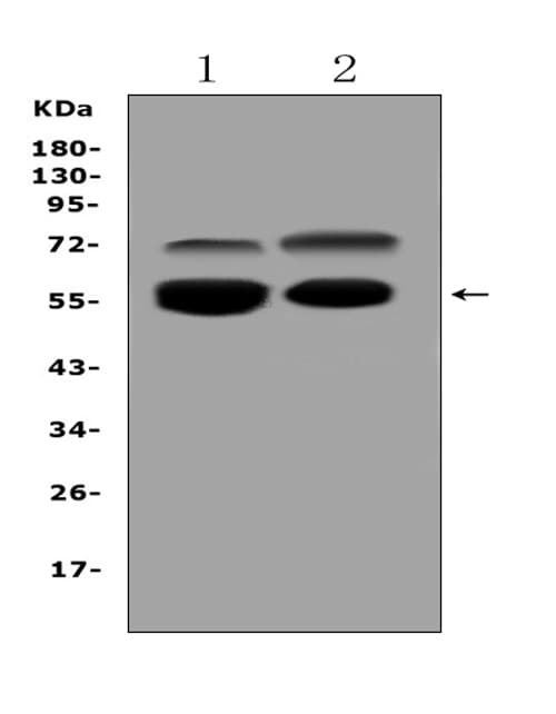 Polyclonal Rabbit anti-Human VNN1 Antibody (WB)