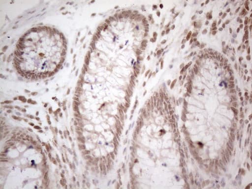 Monoclonal Mouse anti-Human WTAP Antibody (clone OTI6H3, Carrier-free, aa2-106, IHC, WB)