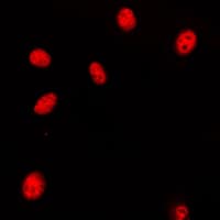 HOXA11+HOXD11 Antibody (C-Terminus)
