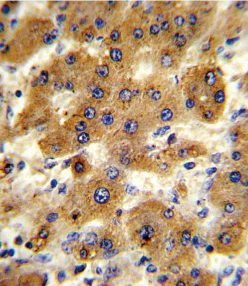 Polyclonal Rabbit anti-Human CYP8B1 Antibody (aa471-501, IHC, WB)