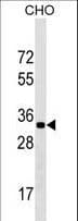 GPATCH11 / CCDC75 Antibody (aa12-41)