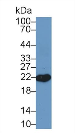 RBP4 Antibody (aa19-201, APC)