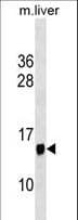 PPP1R1C Antibody (aa50-76)