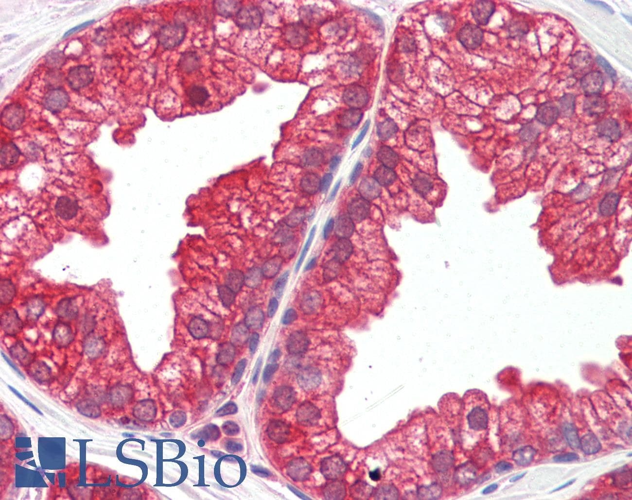 IHC-plus™ MAP2K1 / MKK1 / MEK1 Antibody (N-Terminus)