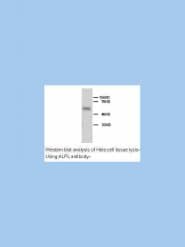 ALPL / Alkaline Phosphatase Antibody (N-Terminus)