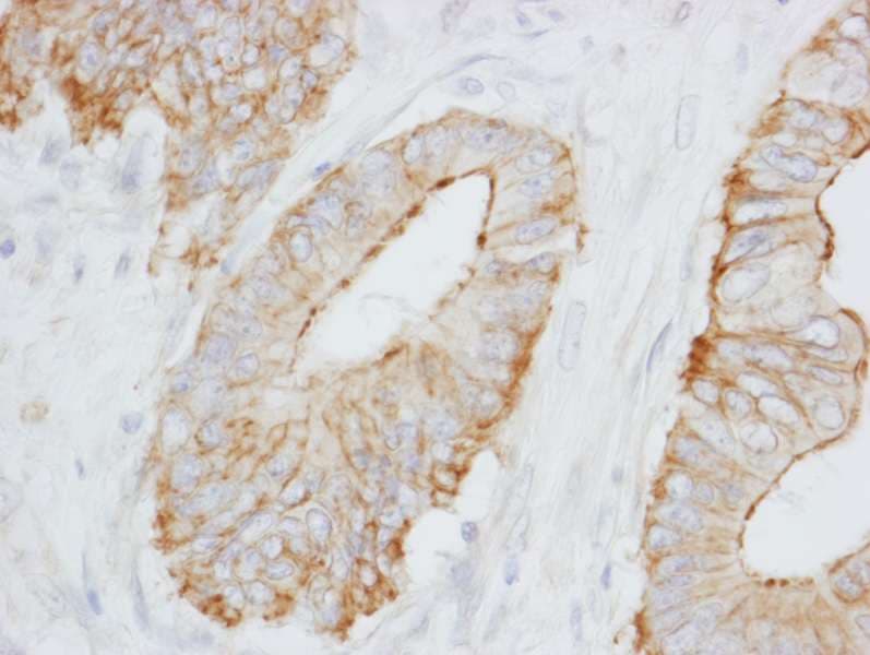 Polyclonal Rabbit anti-Human SPTBN1 / ELF Antibody (aa2100-2150, IHC, WB)