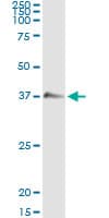 Monoclonal Mouse anti-Human GZMB / Granzyme B Antibody (clone 4F5, WB)