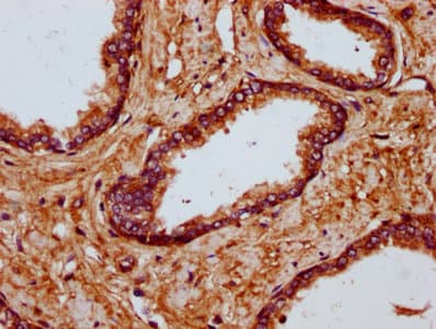 MYO1E / Myosin IE Antibody