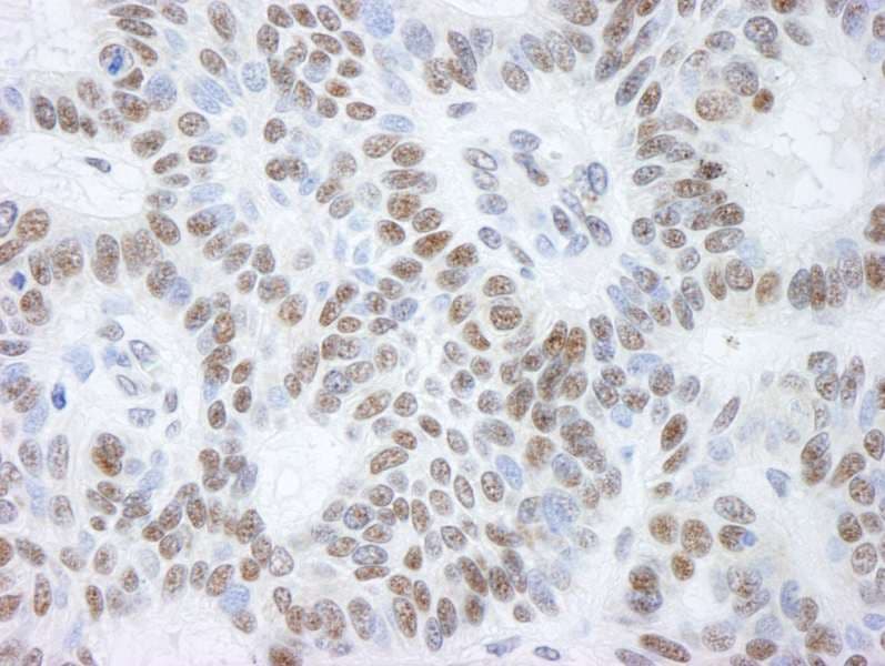 KDM1A / LSD1 Antibody (aa50-100)