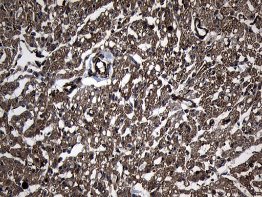Monoclonal Mouse anti-Human UBE2D4 Antibody (clone OTI1B1, IHC, WB)