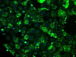 ATP5B / ATP Synthase Beta Antibody (clone OTI6C4)