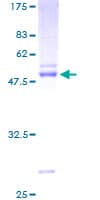 Human EFNA3 / Ephrin A3 Protein (Recombinant GST)