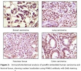 Monoclonal Mouse anti-Human PPARG / PPAR Gamma Antibody (clone 8D1H8F4, IHC, IF, WB)