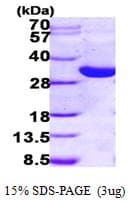 Human HSD17B14 Protein (Recombinant His)