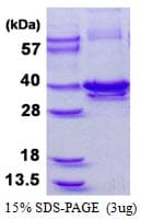 Human CNN1 / Calponin Protein (Recombinant His)
