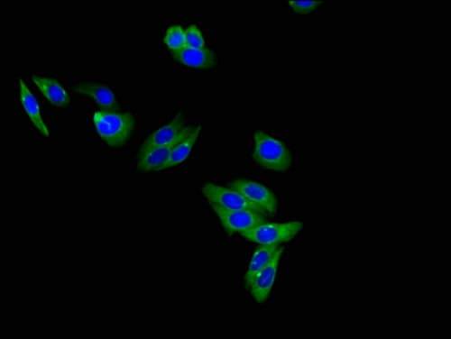 LEPR / Leptin Receptor Antibody