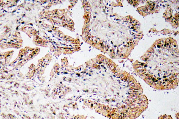 Polyclonal Rabbit anti-Human Calcitonin Antibody (Ile78, IHC)