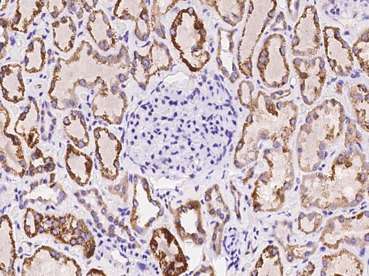 VISA / MAVS Antibody