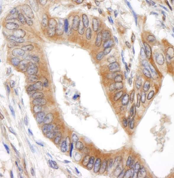 BID Antibody (aa60-120)