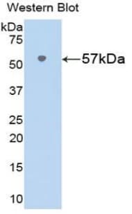 NAMPT / Visfatin Antibody (aa1-491)