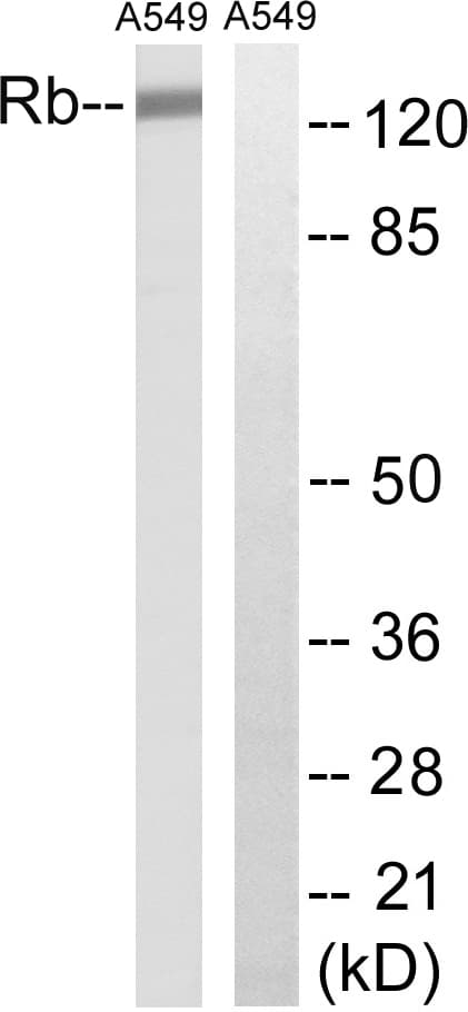 RB1 / Retinoblastoma / RB Antibody (aa221-270)