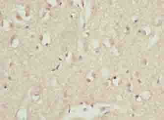 Polyclonal Rabbit anti-Human CDC26 Antibody (IHC)