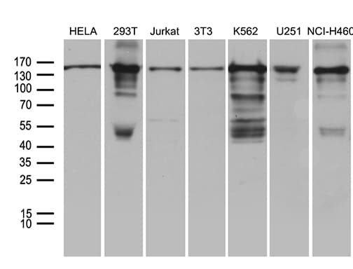 SMC1A / SMC1 Antibody (aa889-1016, clone OTI11E1)