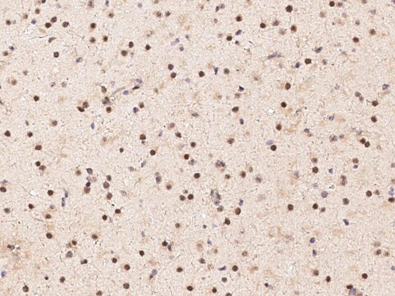 Polyclonal Rabbit anti-Human PSMA5 Antibody (Preservative Free, IHC, WB)