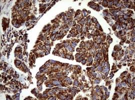 PIK3CD / PI3K Delta Antibody (aa286-610, clone OTI1D11)