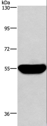 Polyclonal Rabbit anti-Human HMGCS1 / HMG-CoA Synthase 1 Antibody (IHC, WB)