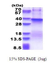 Human FUT7 Protein (Recombinant His)