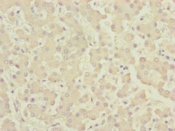 CENPK Antibody