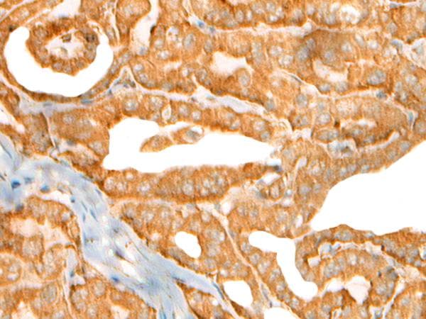 Polyclonal Rabbit anti-Human CEP72 Antibody (IHC)