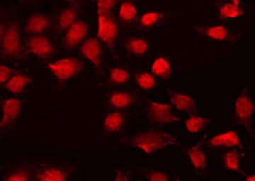 RELA / NFKB p65 Antibody (phospho-Ser311)