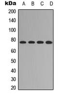 Polyclonal Rabbit anti-Human FOXO1 / FKHR Antibody (phospho-Ser329, IHC, IF, WB)
