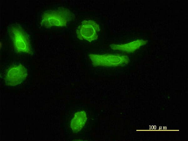 IHC-plus™ ARH / LDLRAP1 Antibody (clone 4G4-D5)